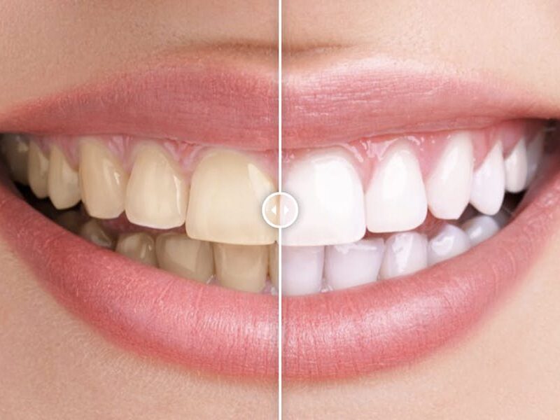 Before & After Images Comparison WordPress Plugin